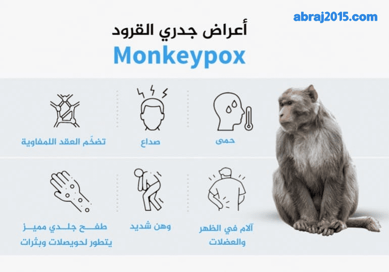 أعراض جدري القرود أعراض جدري القرود